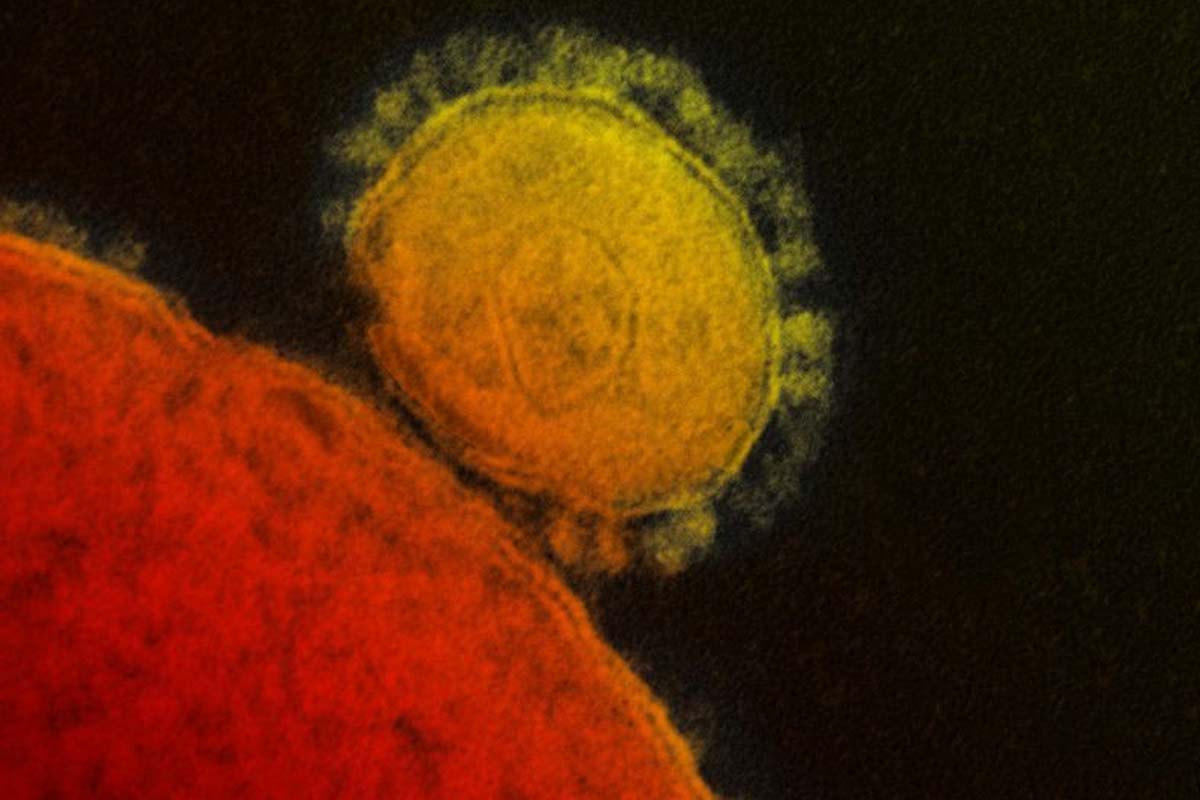 epidémie koronavírusu mohli zažiť aj naši predkovia