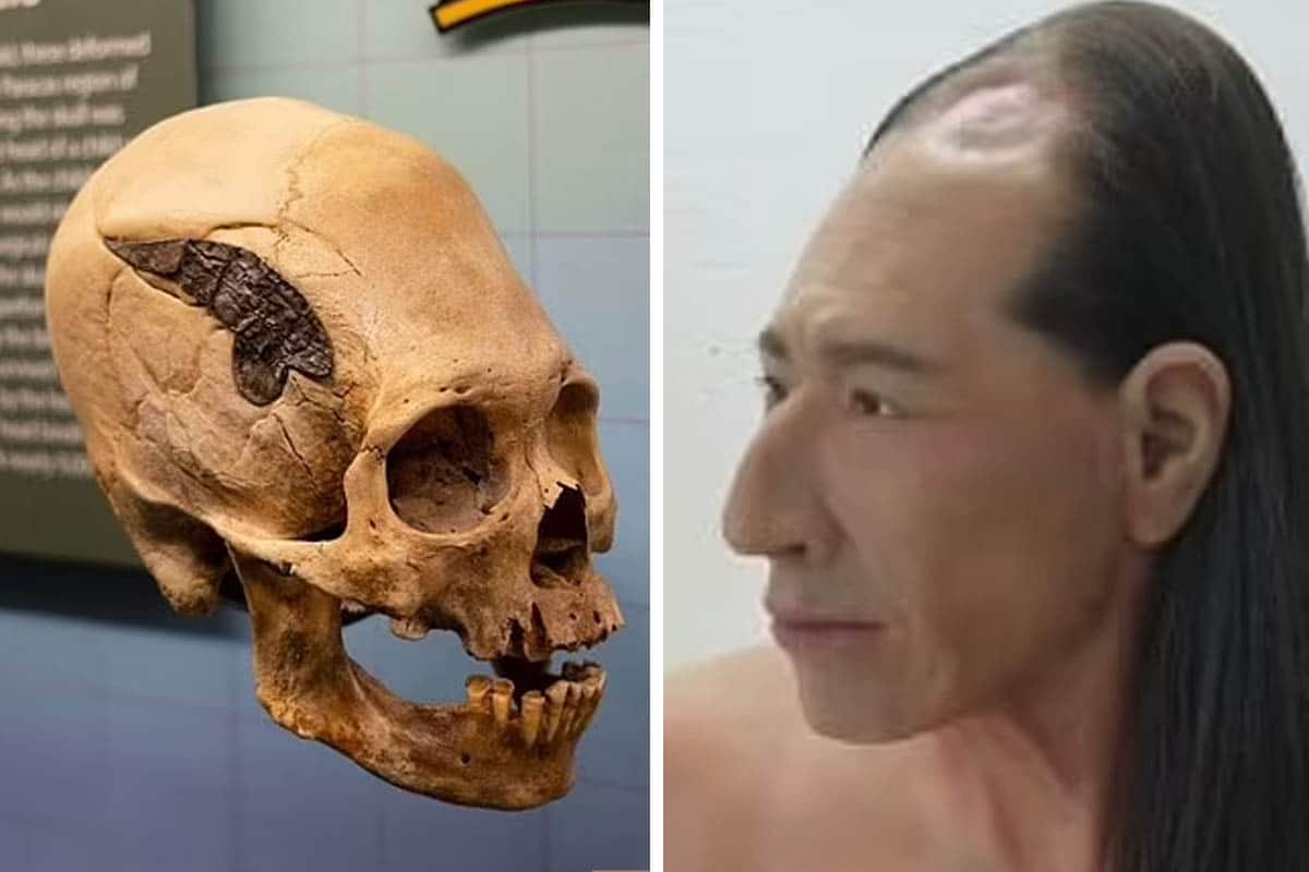 Už pred dvetisíc rokmi naši predkovia ovládali komplexné chirurgické zákroky