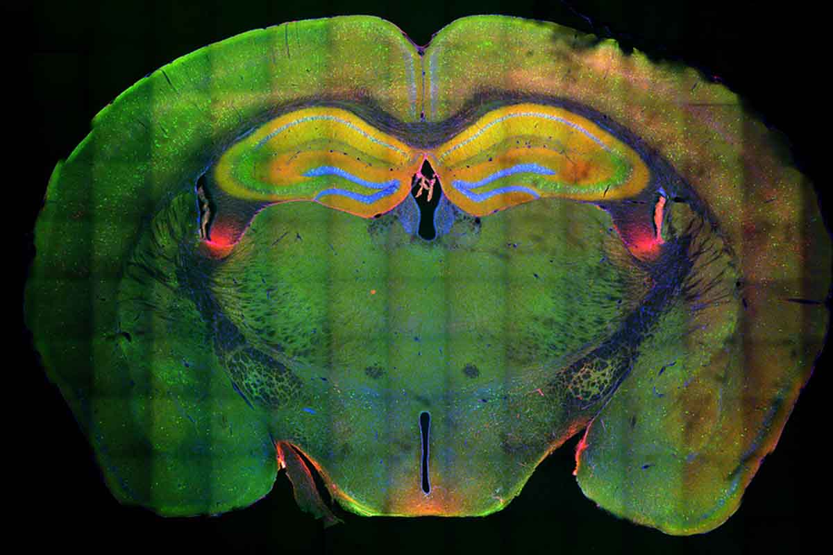 Ako dokáže náš mozog ukladať nové spomienky?