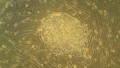 Nová štúdia ukazuje zázračný účinok kmeňových buniek, vytvorených z moču