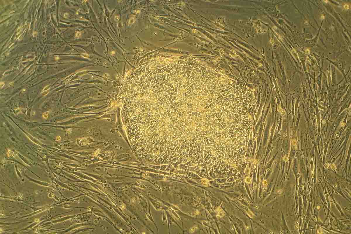Nová štúdia ukazuje zázračný účinok kmeňových buniek, vytvorených z moču