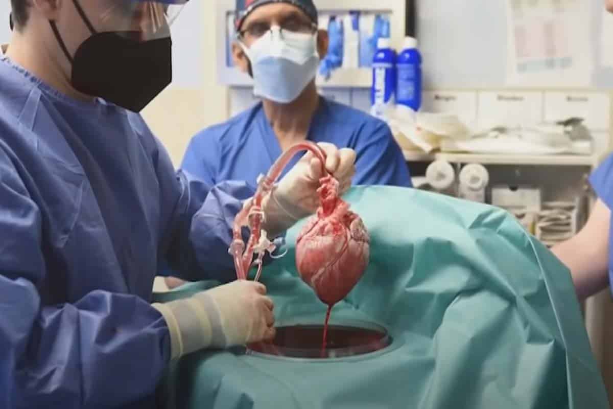 Lekári majú za sebou dve úspešné transplantácie geneticky upraveného srdca prasaťa. Zachrániť môžu nespočet životov.