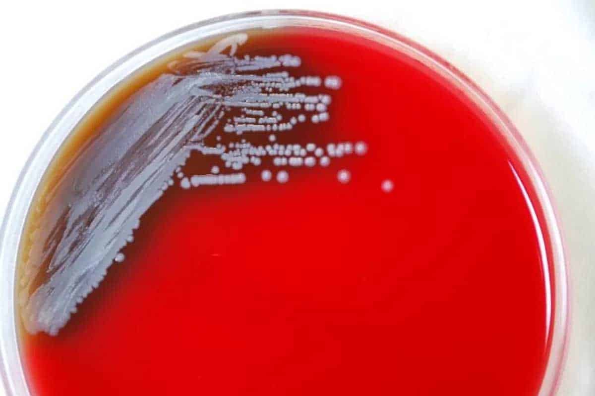 Na území Spojených štátov sa objavila nová, potenciálne smrteľná baktéria