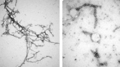 Našli vedci eso v boji proti Parkinsonovej chorobe?