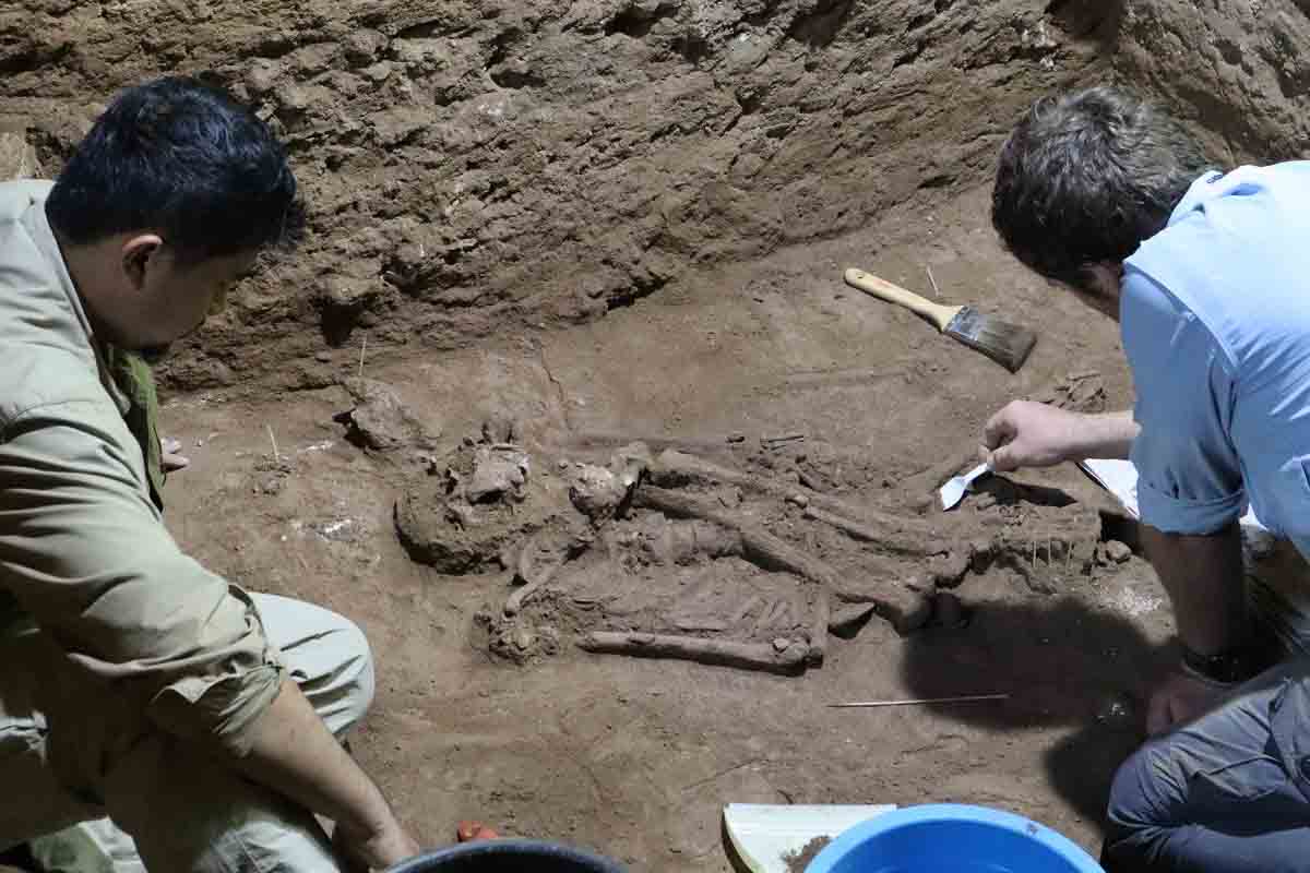 Prvá amputácia sa mohla udiať oveľa skôr, než archeológovia predpokladali. 