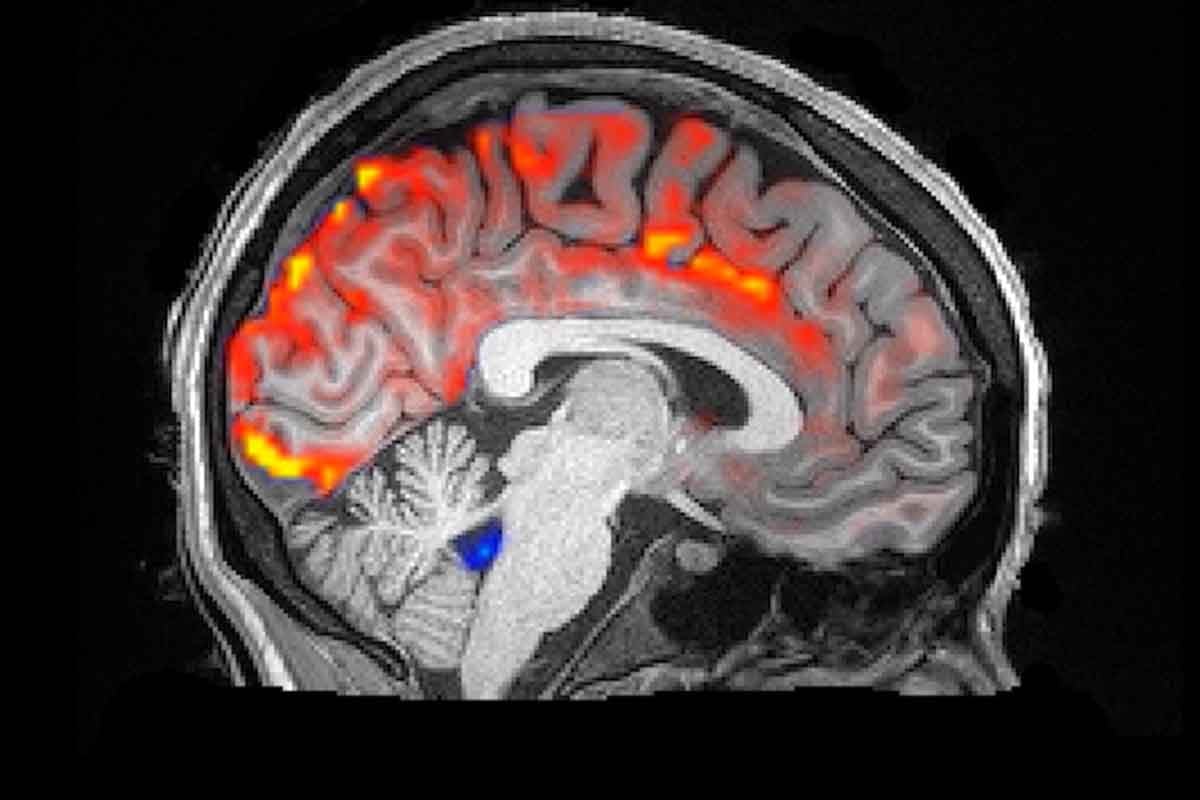 Čo sa deje v našom mozgu počas toho, ako spíme?