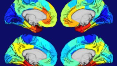 Alzheimerova choroba postihuje určité regióny mozgu a autori štúdie prichádzajú na to, prečo je to tak