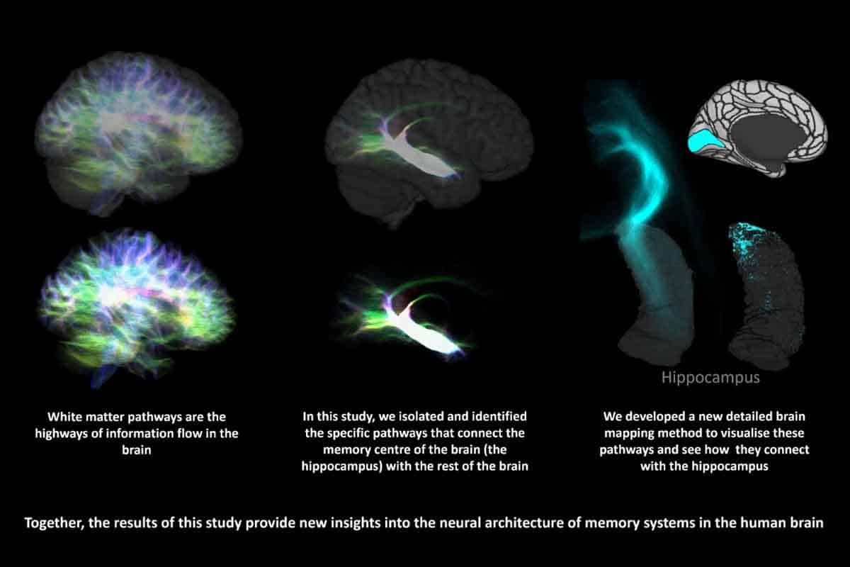 Najdetailnejšia mapa mozgu priniesla záhadu.