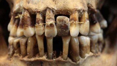 Zubárstvo 17. storočia ukazuje dôležitosť dokonalého vzhľadu