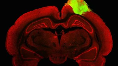 Vedci úspešne transplantovali ľudský organoid do mozgu dospelého potkana