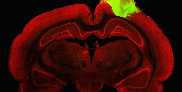 Vedci implantovali ľudský organoid do mozgu dospelého potkana: Neuróny...