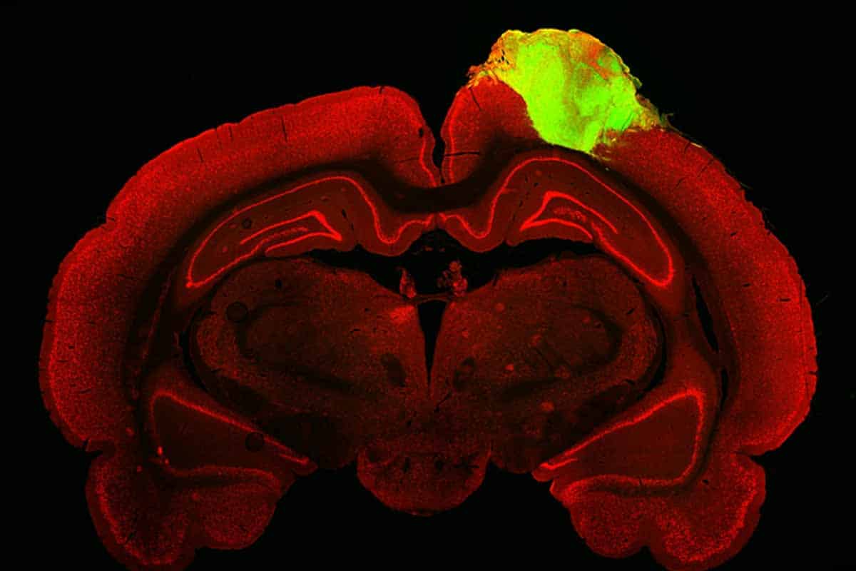 Vedci úspešne transplantovali ľudský organoid do mozgu dospelého potkana
