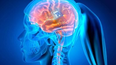 cip implantant mozgu