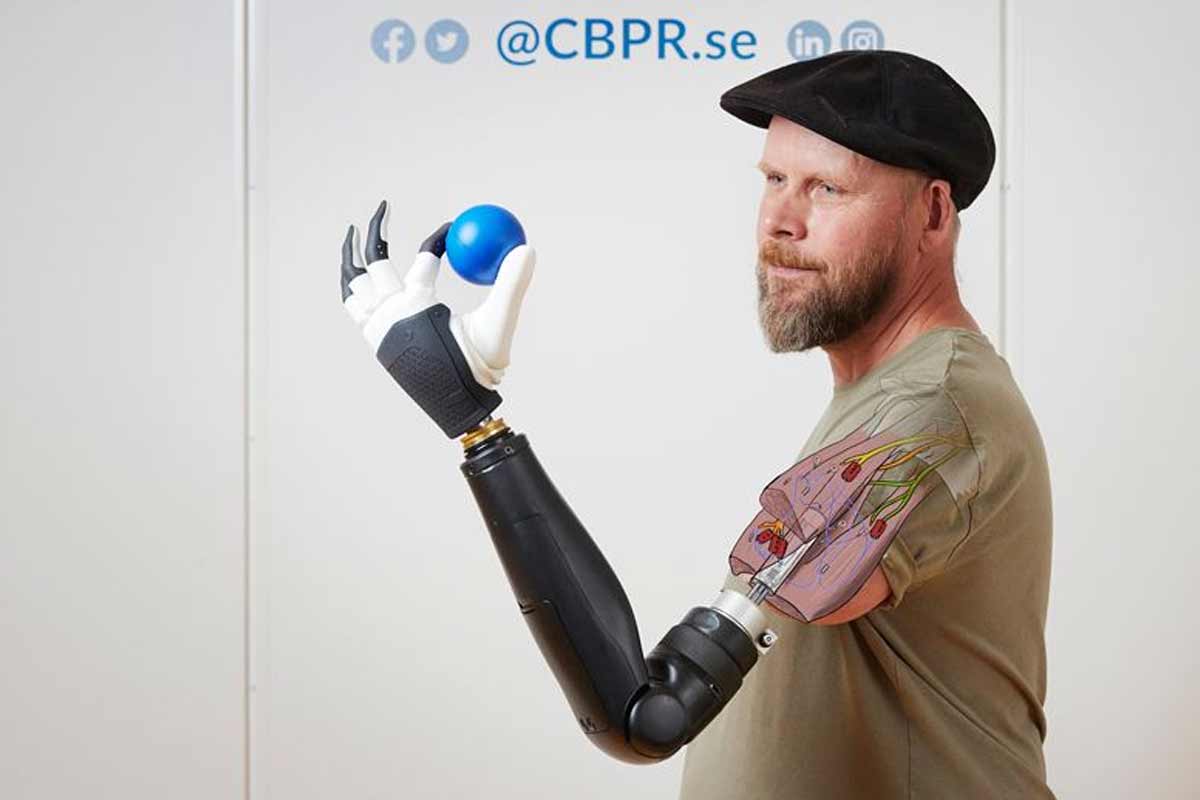 robotická ruka dáva pacientovi možnosť úplného pohybu.