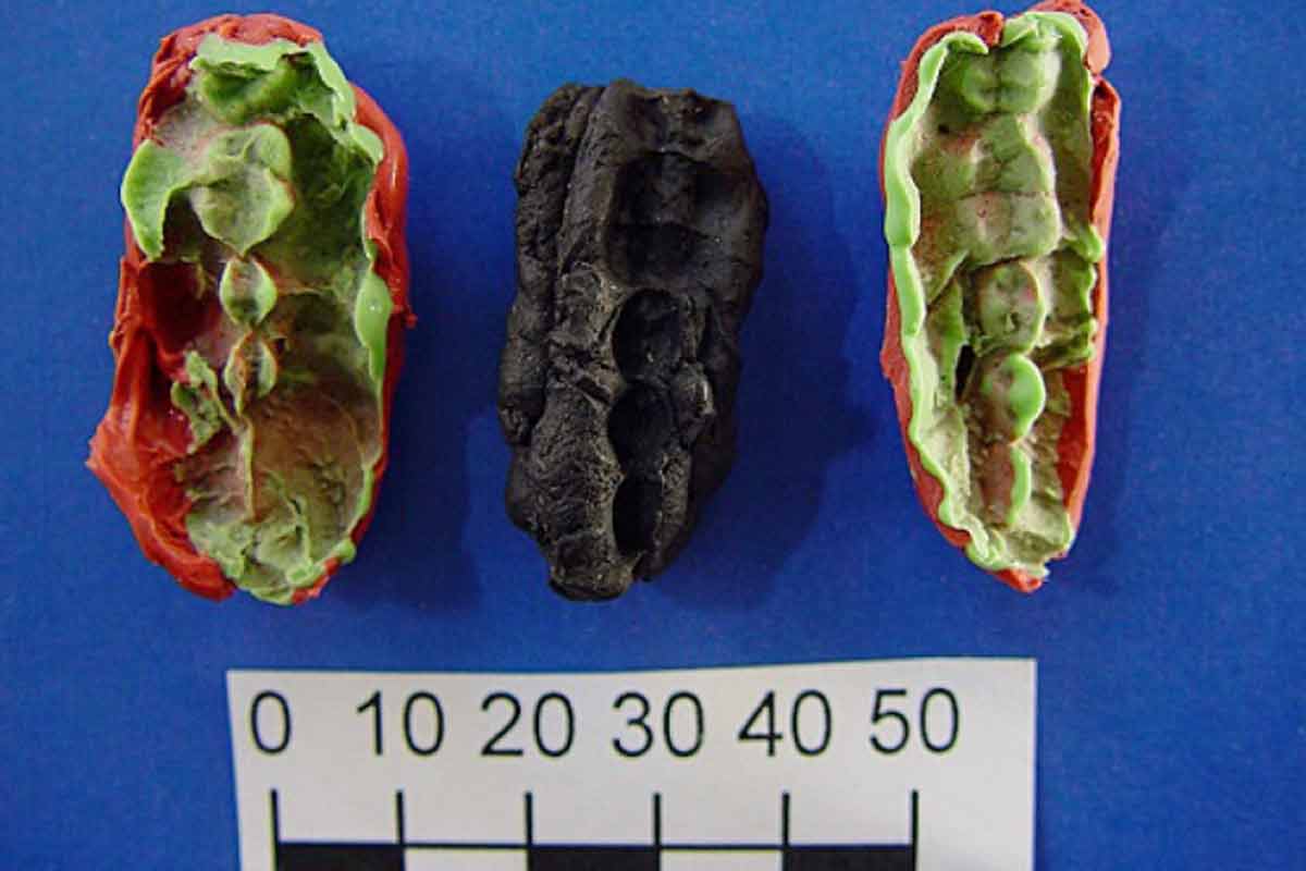 prehistorická živicová žuvačka vedcom ukázala čo jedli naši predkovia a aké mali zuby