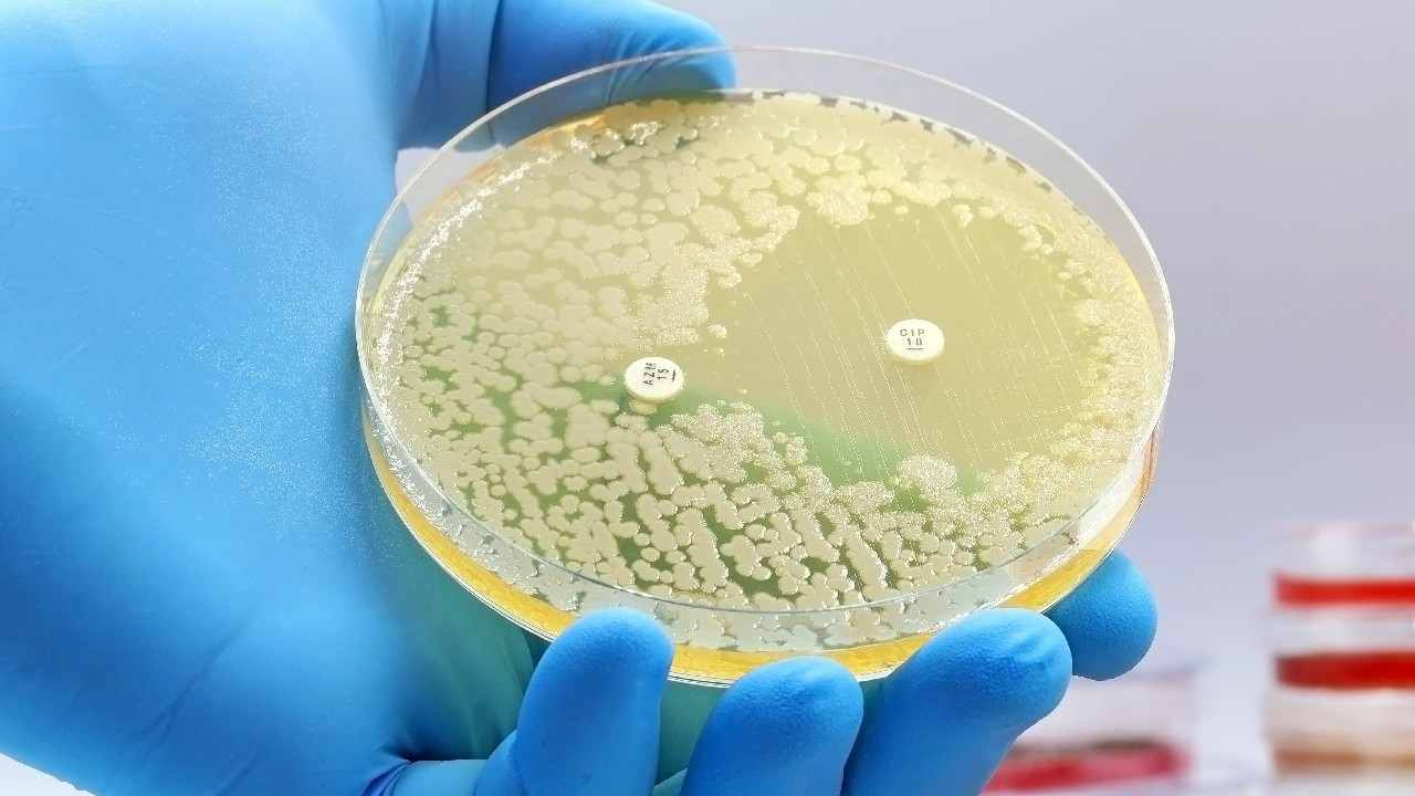bakterie antibiotika_titulka