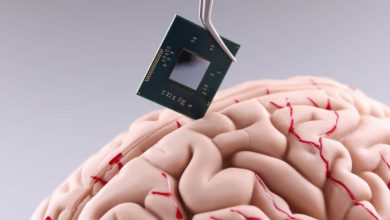 cip mozog implantat
