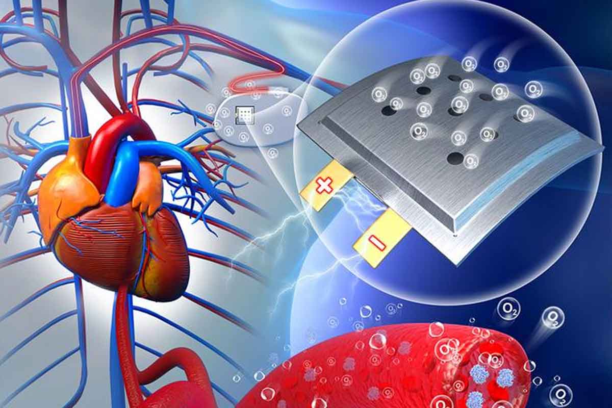 Batéria na kyslík môže pomôcť pacientom s kardiostimulátormi