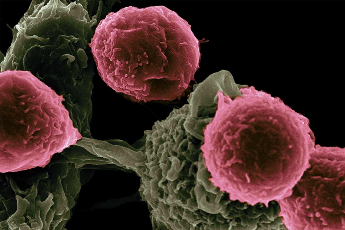Vedci našli prelomový spôsob liečby rakoviny