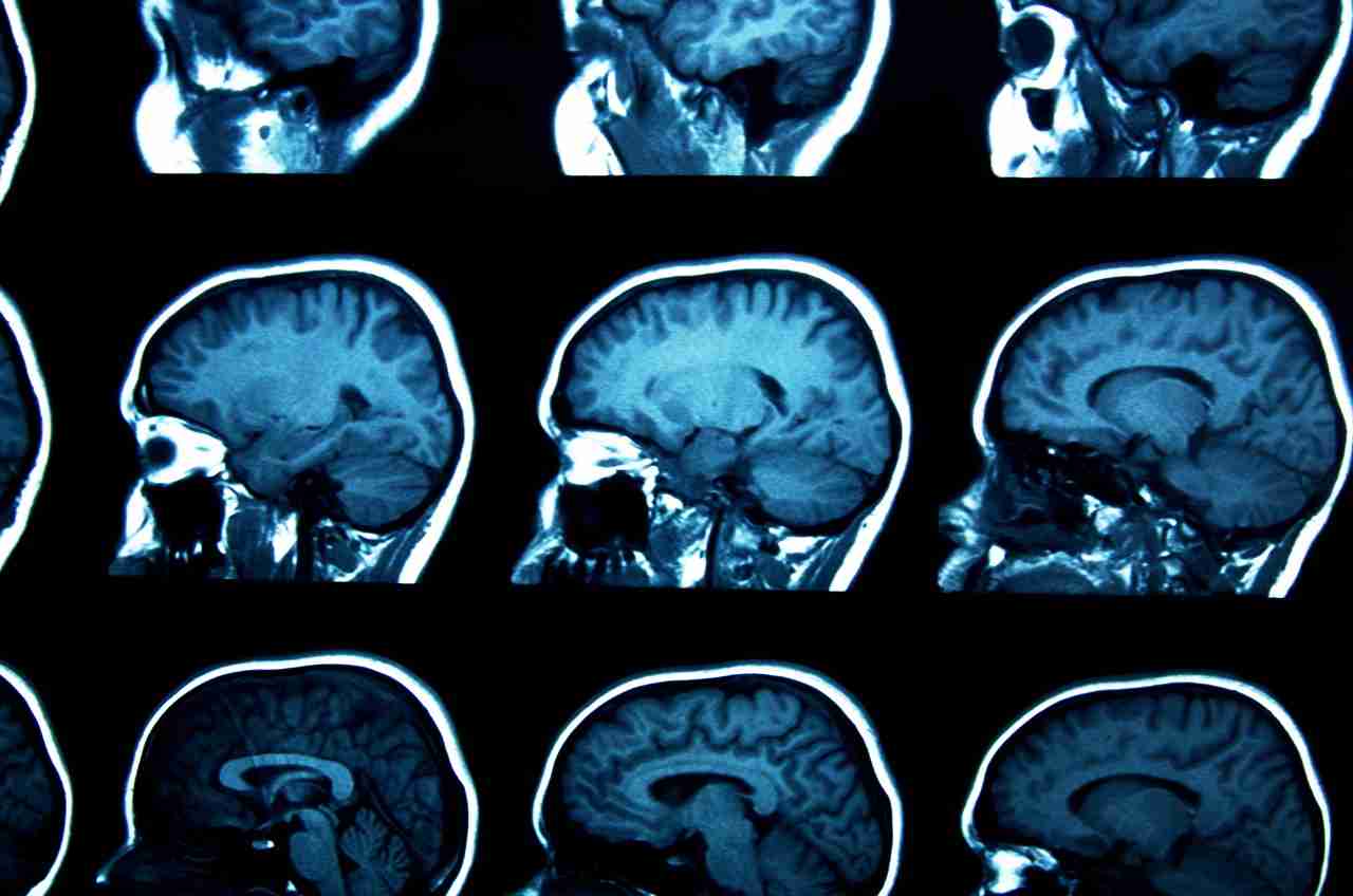 AI od Mety sa priblížila k čítaniu myšlienok. Dokáže to bez implantátu aj bez operácie mozgu