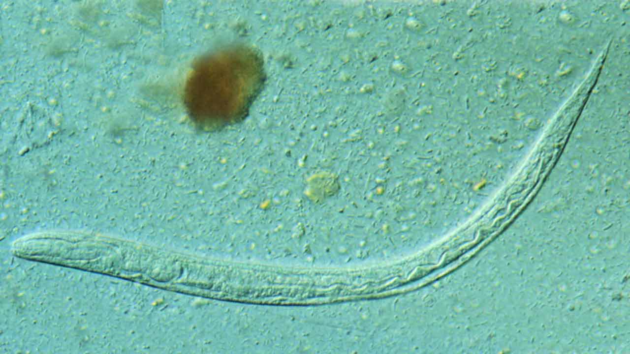 Parazit, ktorého sa ľudia boja, môže raz liečiť choroby. Vedci ho geneticky upravili na živú továreň na liečivá