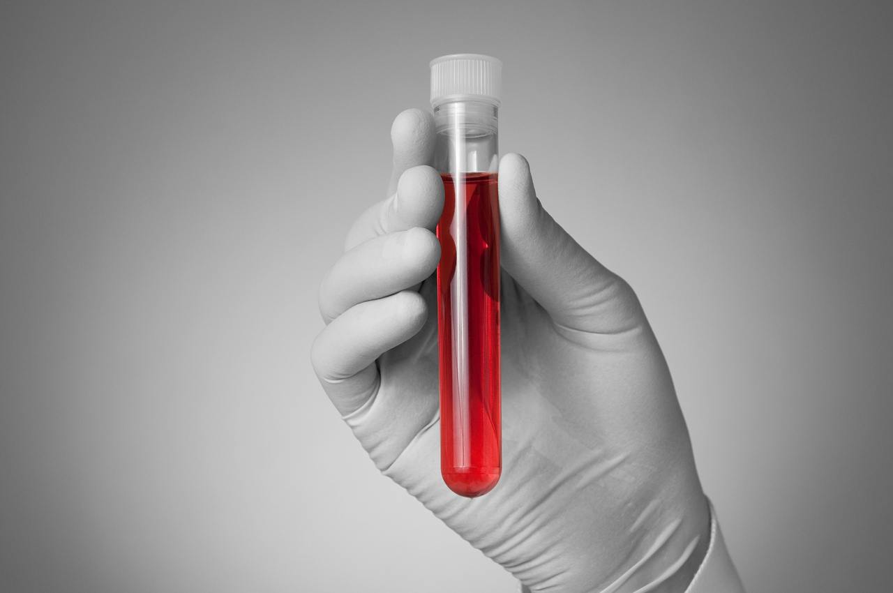 Nový AI krvný test dokáže odhaliť riziko infarktu či mŕtvice až 15 rokov vopred