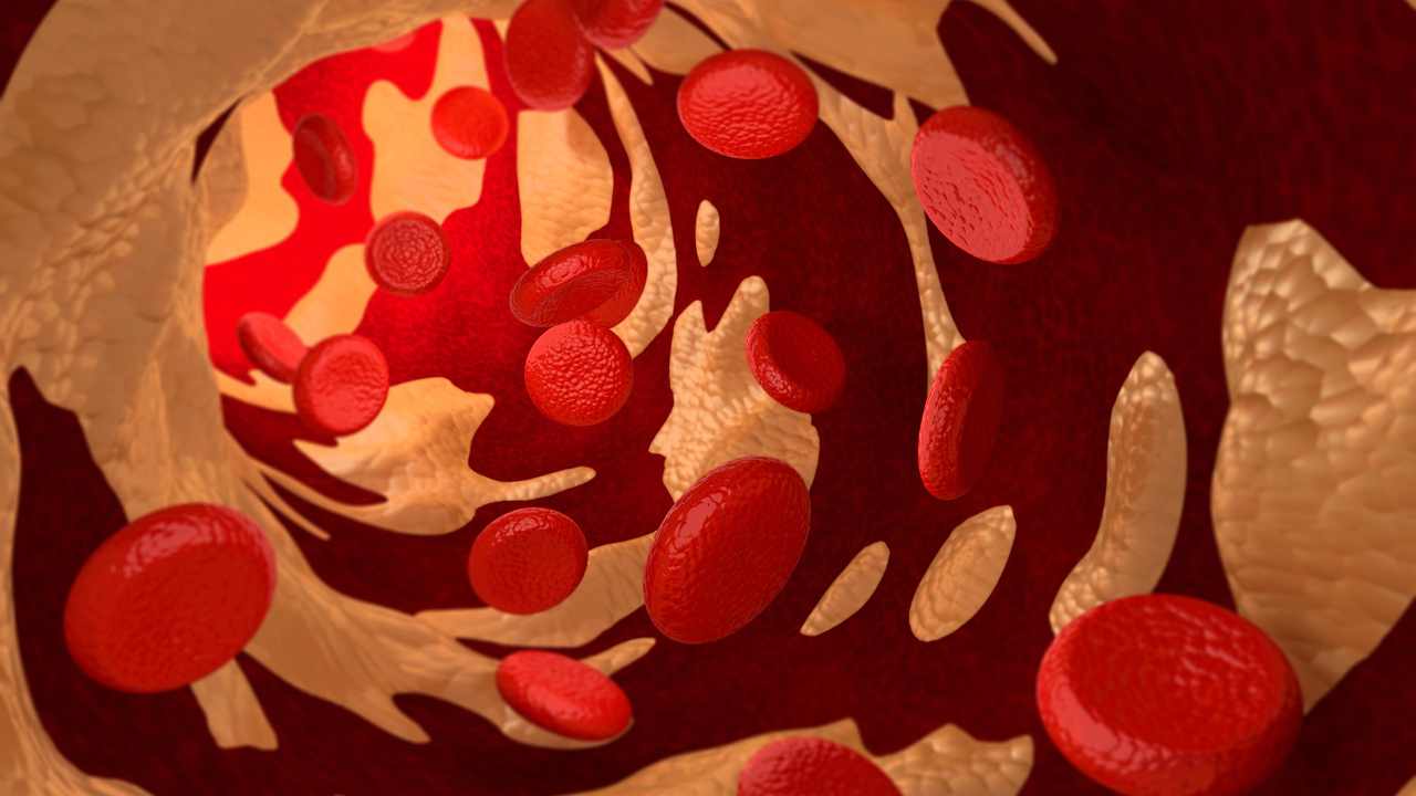 cholesterol